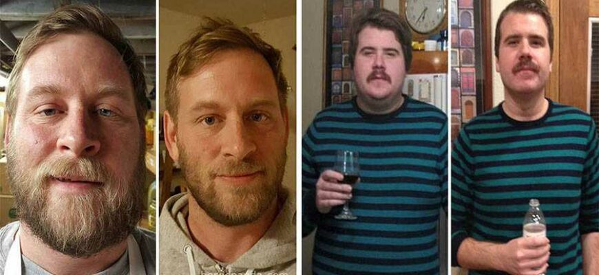 50 фото До и после : как меняется внешность человека, который перестает пить