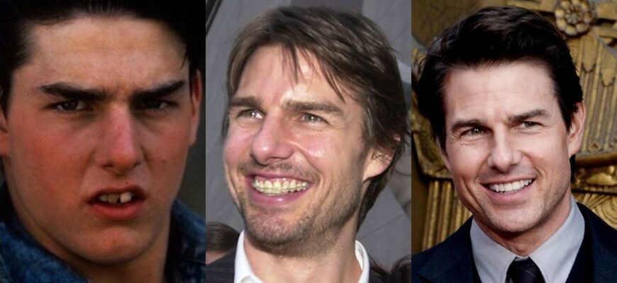 50 смешных фото Знаменитостей до и после посещения России