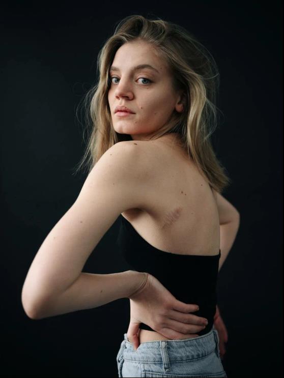 На этом фото Карина Александрова показала фанатам шрам на своей голой спине. На этом фото Карина Александрова показала фанатам шрам на своей голой спине.